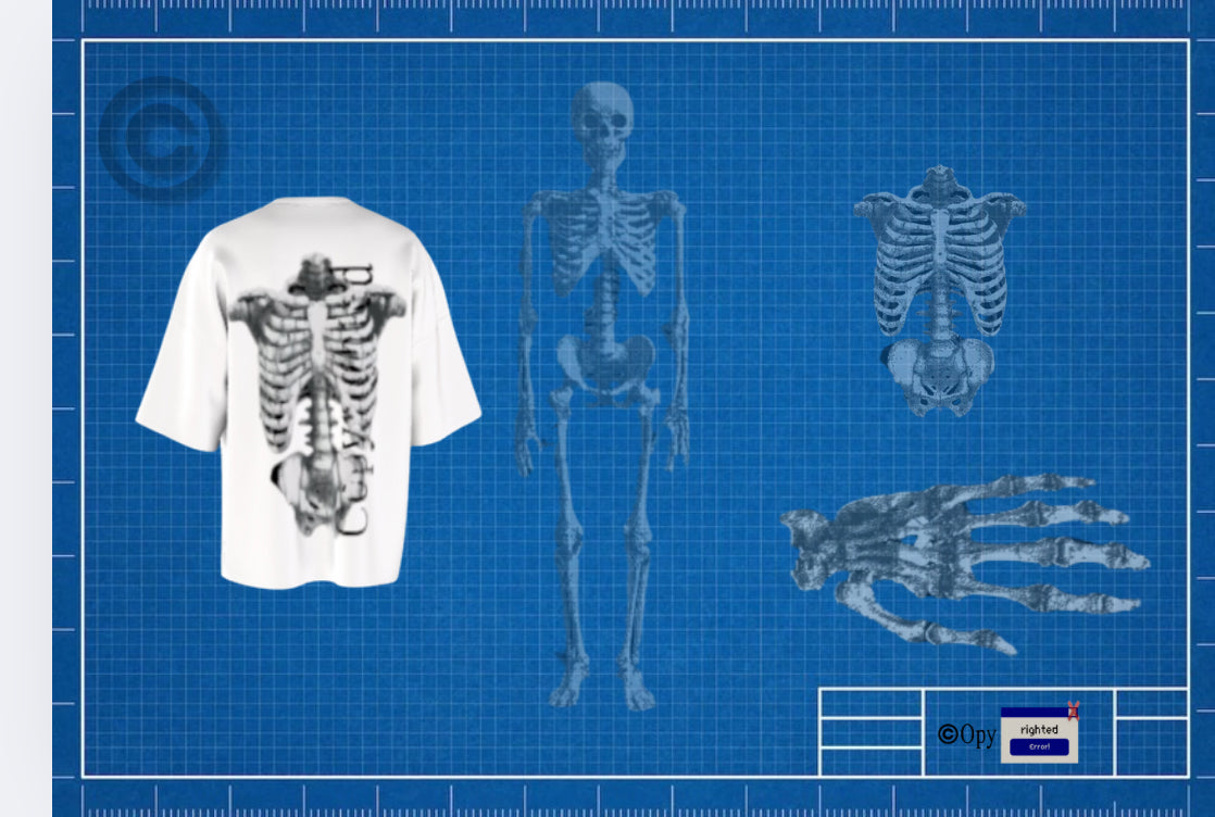 “Rib caged”