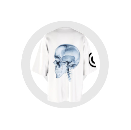 skull X-ray