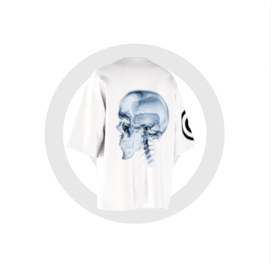 skull X-ray